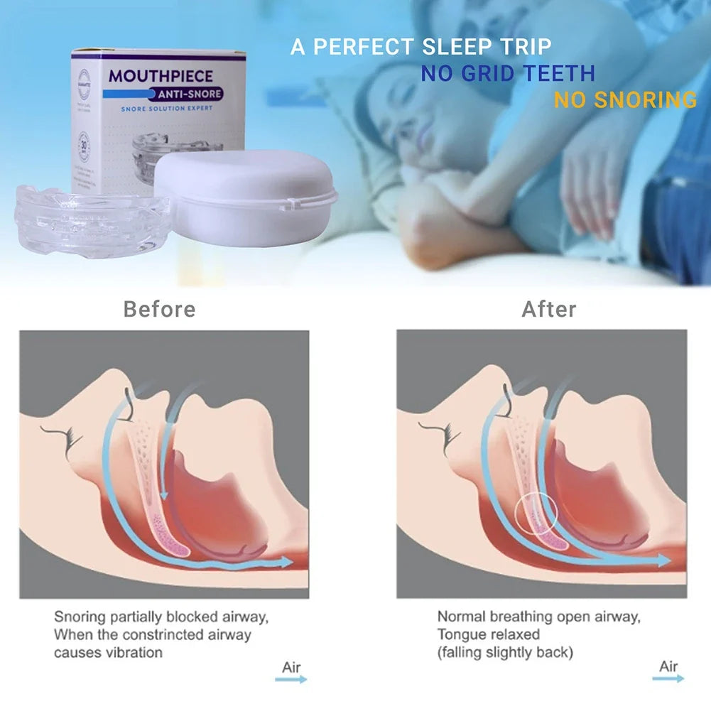 Light & Reusable – Travel-Friendly Mouth Guard with Storage Box