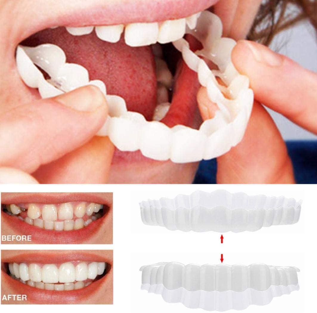 Veneers Smile Upper And Lower Instant Cover For All Day
