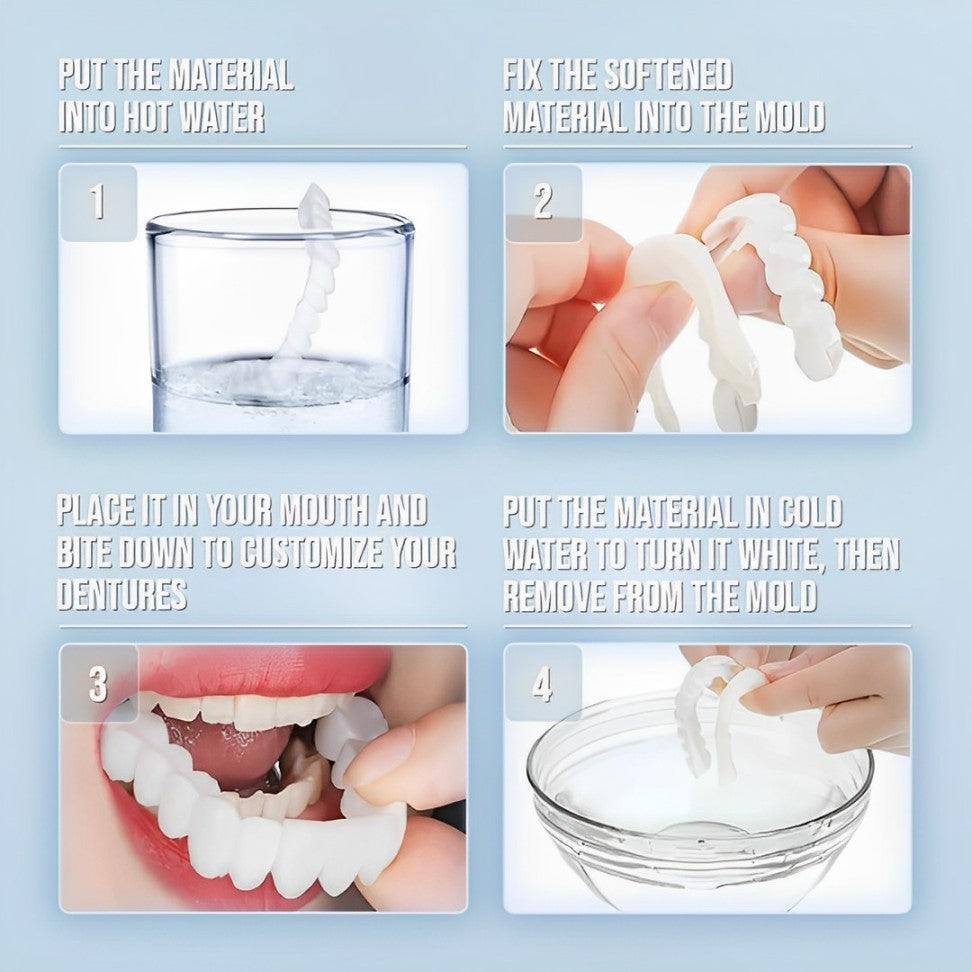 Veneers Smile Upper And Lower Instant Cover For All Day