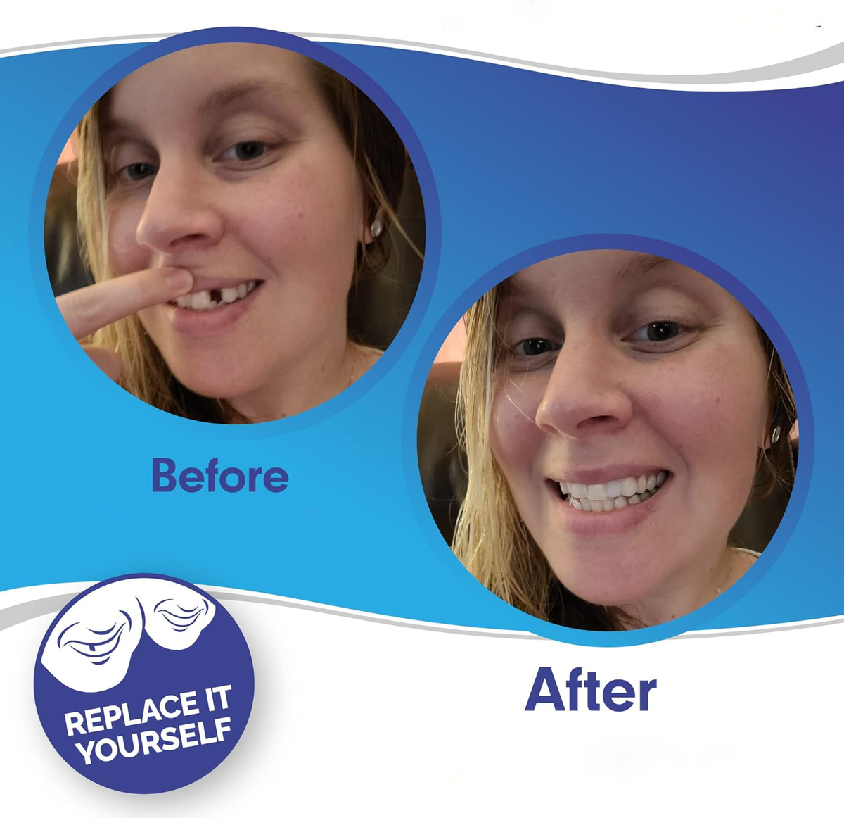 Veneers Smile Upper And Lower Instant Cover For All Day