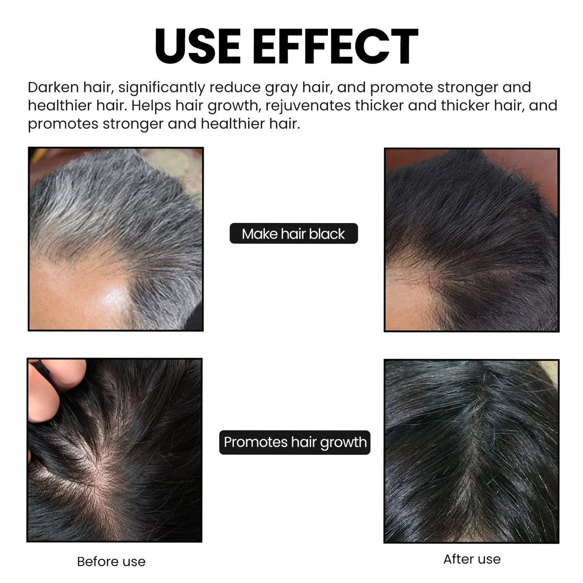 Deep Scalp Cleanse Oil Control Hair Nourishing TikTok Viral 2026 – Bamboo Charcoal Shampoo Soap Bar 60g