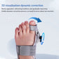 Flexible Bunion Pain Relief & Toe Alignment Brace – Footara Pro™