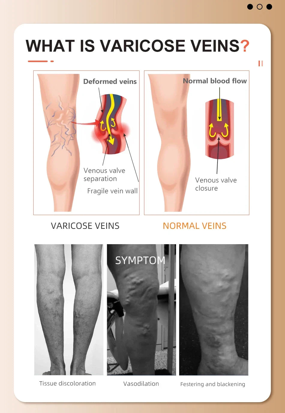 Varicose Veins Support Calf Sleeve Unisex S–7XL 2026 – Medical Grade Compression Stockings 34–46mmHg Class 3