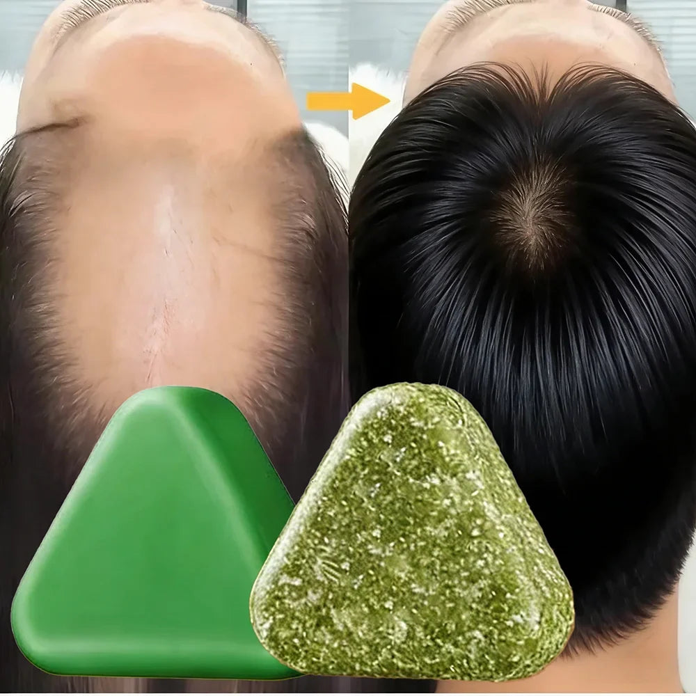 Herbal Shampoo Soap Handmade Hair Maintenance for All Hair Types Oil Control Refreshing Fall 2026 Trend