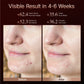 LED Light Therapy Mask 4D Facial Device Anti Aging And Acne Maintenance Fall 2026 Skincare Trend