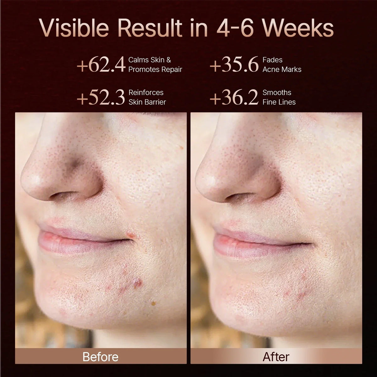 LED Light Therapy Mask 4D Facial Device Anti Aging And Acne Maintenance Fall 2026 Skincare Trend