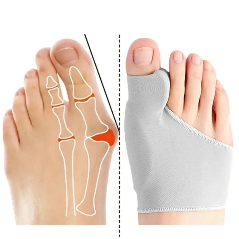 Orthopedic Foot Straightener Relief 2026 – Hallux Valgus Bunion Corrector Toe Separator Kit