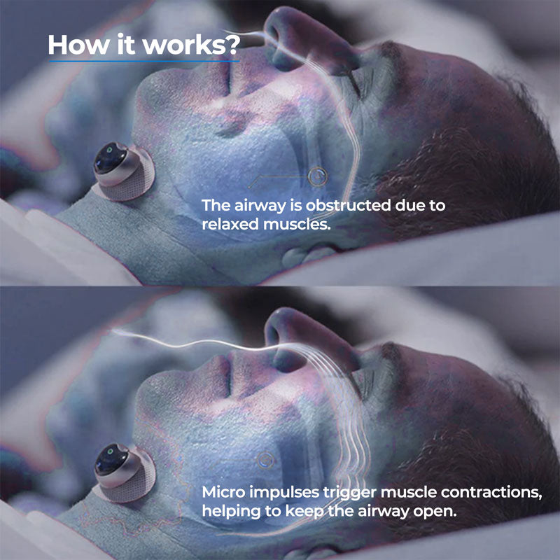 Snore Anti Device Chin Clip Sleep Aid For Quiet Nights
