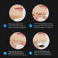 Snore Anti Device Chin Clip Sleep Aid For Quiet Nights