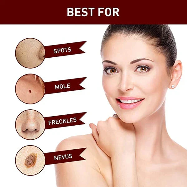 Skin Tag Mole Remover Pen With Tea Tree Oil Fast Household