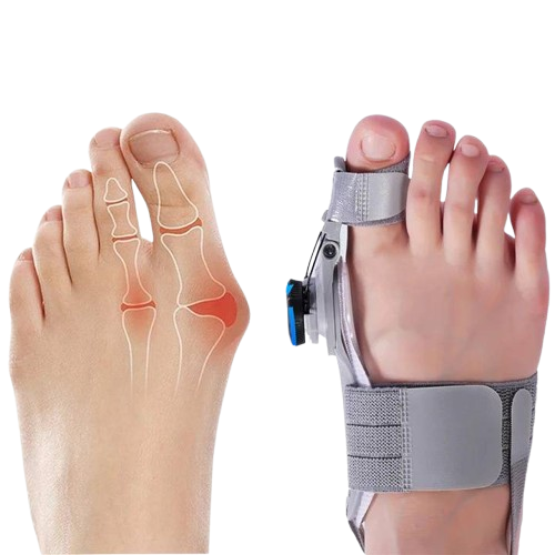 Bunion Corrector Toe Spacer Flexible Orthotic Toe Realignment Fall 2026 Comfort and Pain Relief